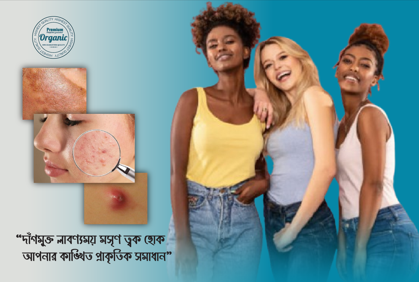 সানফিকেয়ার অর্গানিক স্কিন কেয়ার — ত্বকের দাগ দূর করে প্রাকৃতিক উজ্জ্বলতা ফিরিয়ে আনে